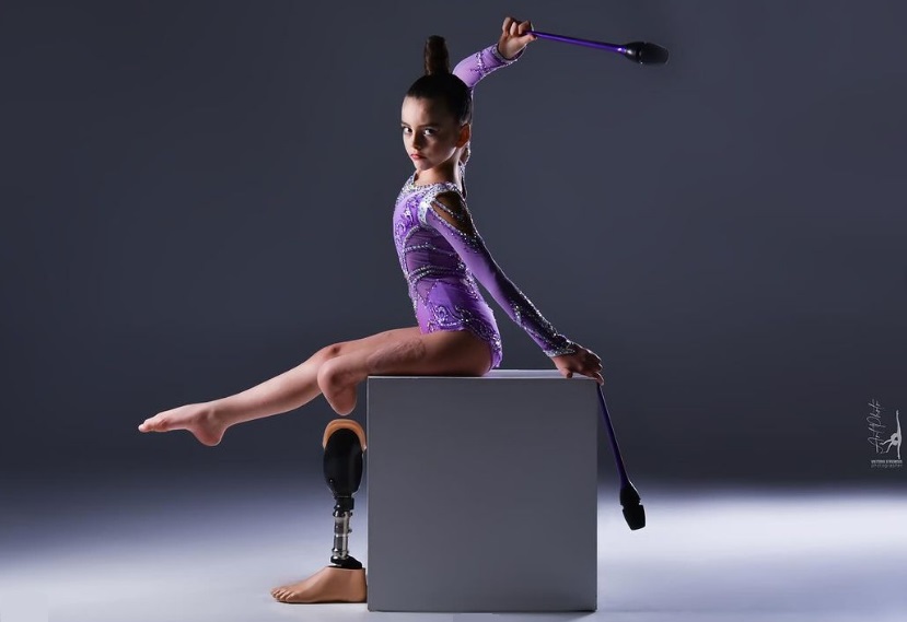 Враг искалечил, но не сломал. Как сегодня живет 7-летняя гимнастка с протезом Саша Паскаль: сильные фото